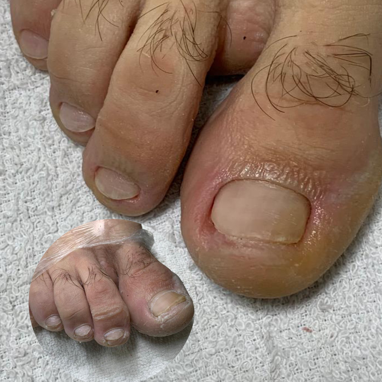 Pedicure masculino