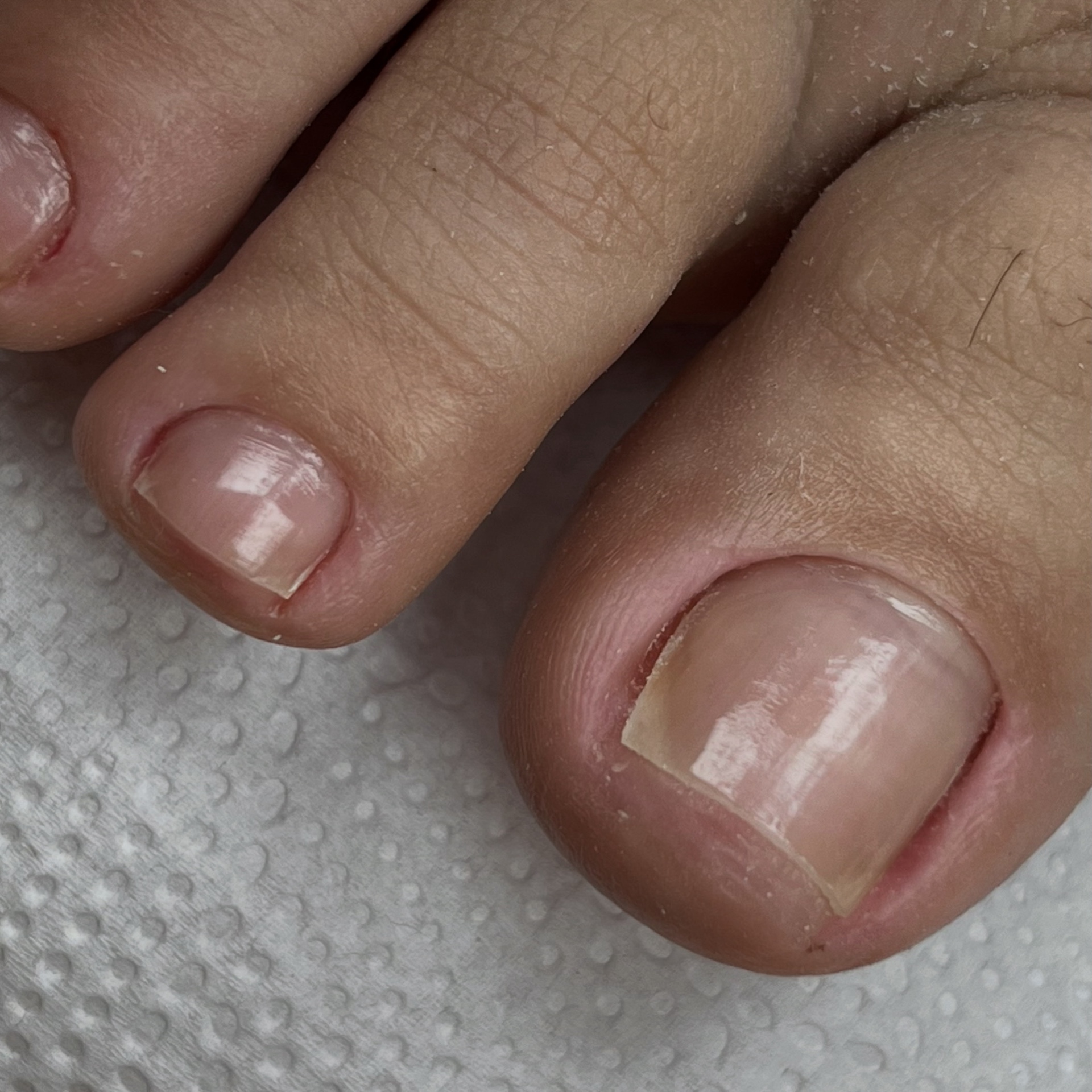 Pedicure